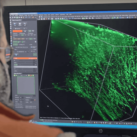 3d image analysis of blood vessel signaling activity linking to Customized Physiology and Imaging Core