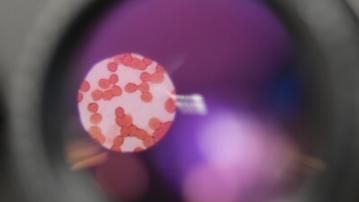 view of microbes through a microscope