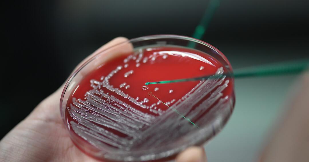 Testing germs