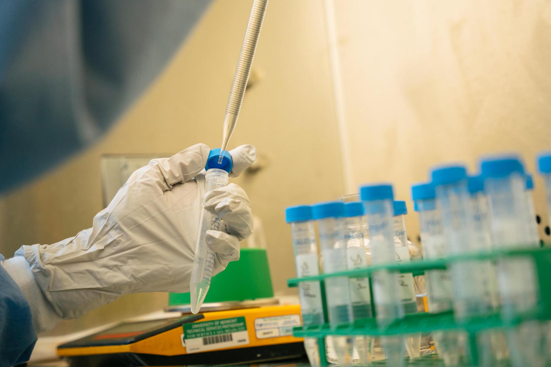 Hand doing lab work